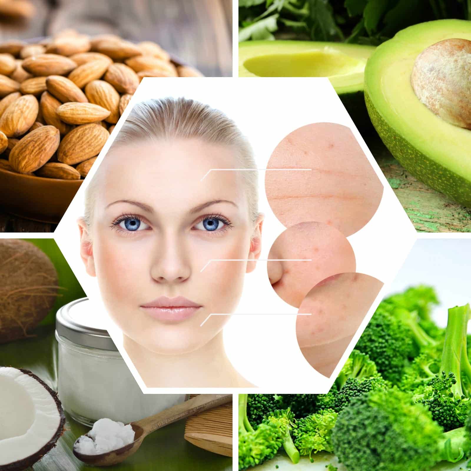 14 Super Foods for Acne Prone Skin