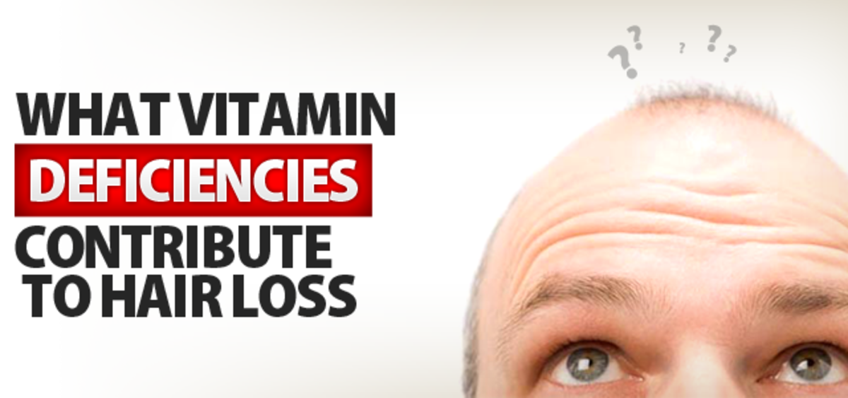 16 Vitamin Deficiencies that Lead to Hair Loss