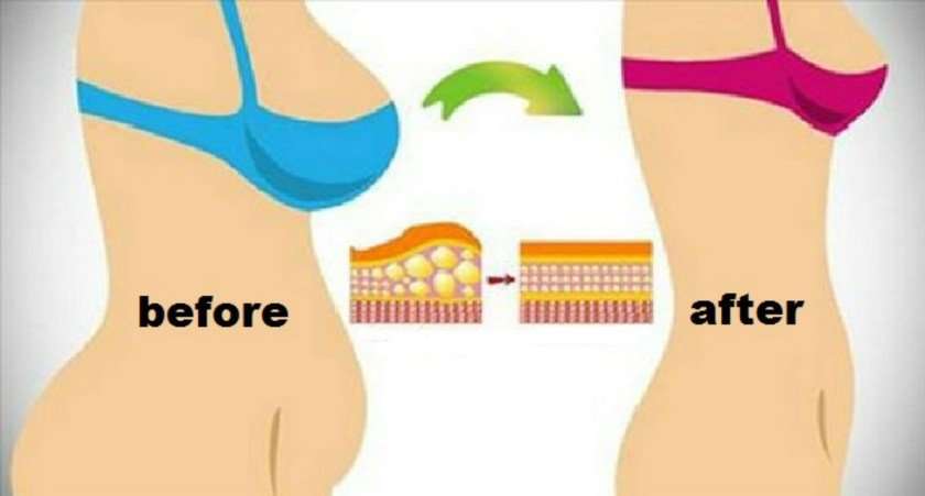 3 Ways To Reverse Hormonal Weight Gain and Eliminate ...