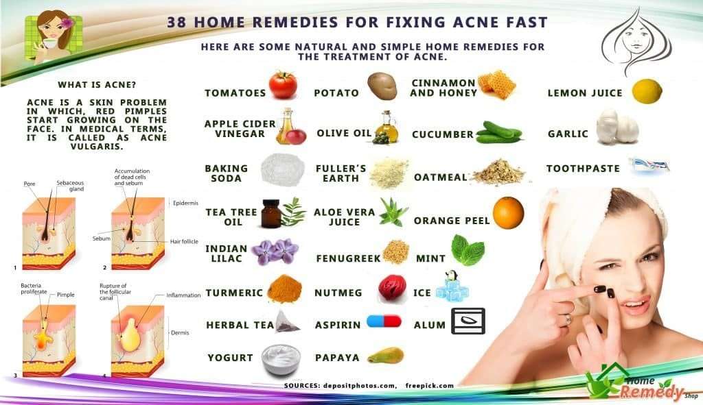 38 Home Remedies for Fixing Acne Fast