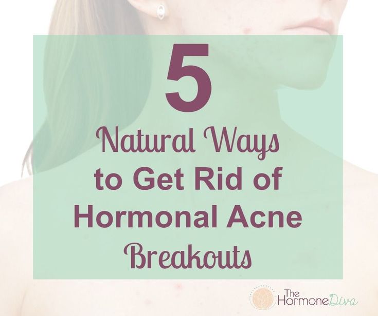 5 Natural Ways to Get Rid of Hormonal Acne Breakouts