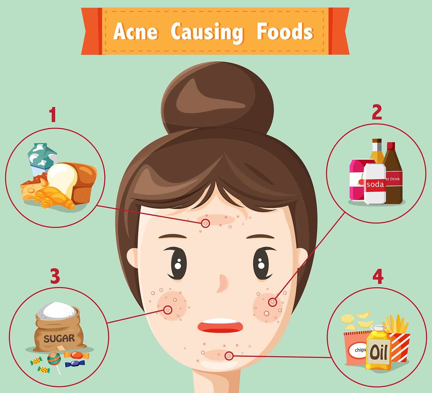 6 Foods that Cause Acne  DrFormulas