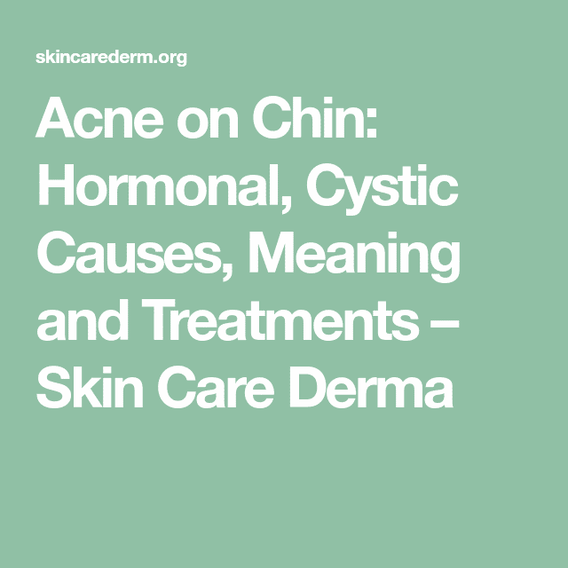 Acne on Chin: Hormonal, Cystic Causes, Meaning and Treatments  Skin ...
