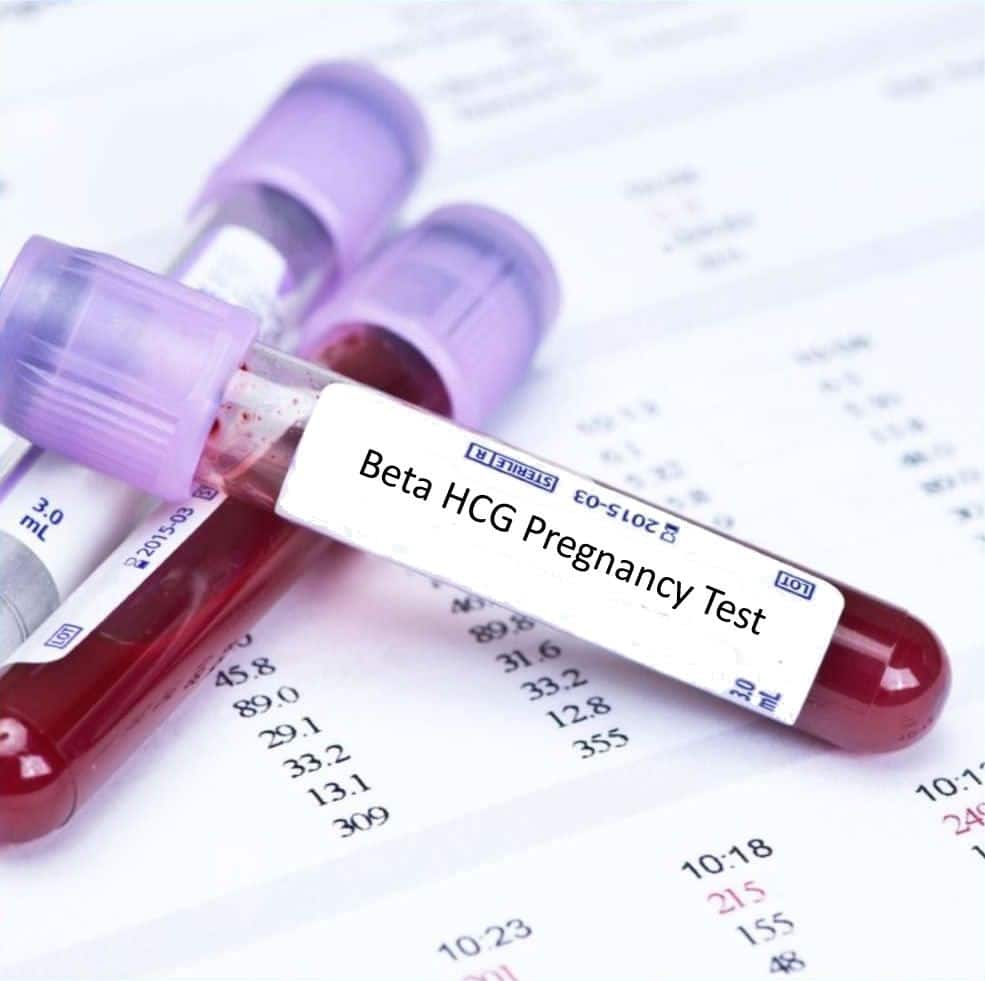 Beta HcG Male (Oncology)