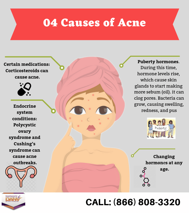 Body Acne Causes