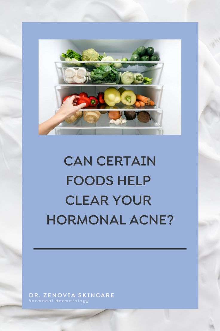 Can Certain Foods Help Clear Your Hormonal Acne ...
