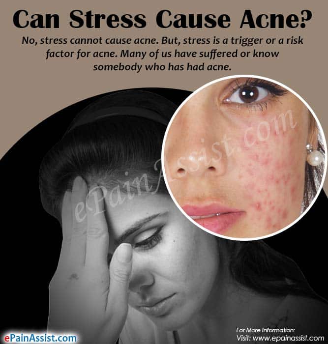 Can Stress Cause Acne?