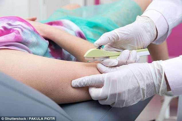 Contraceptive implants are being given to girls as young ...