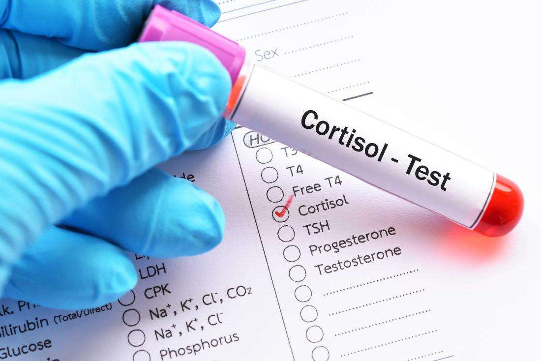 Cortisol level test: Purpose, procedure, and results