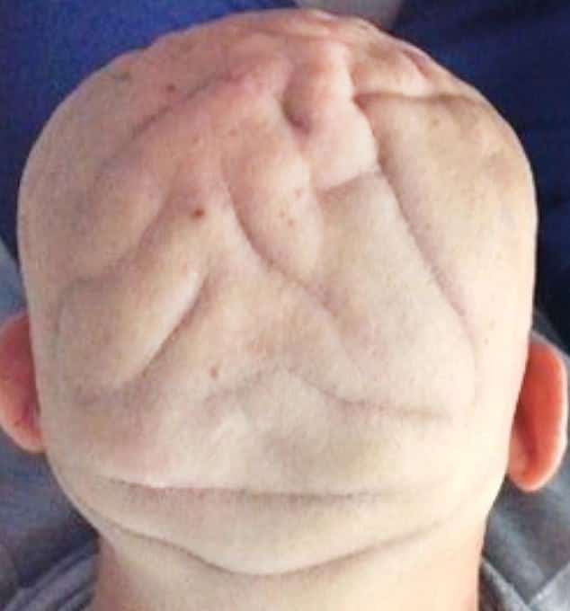 Doctors release pictures of bizarre pattern on man