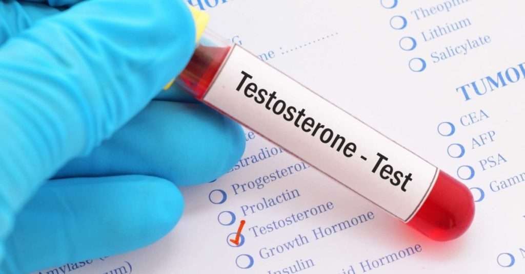 Does Cialis Help To Increase Testosterone Levels?