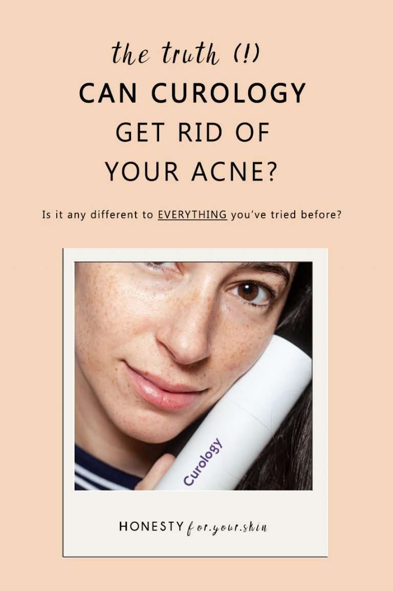 Does Curology Work? Does Curology Work For Acne?