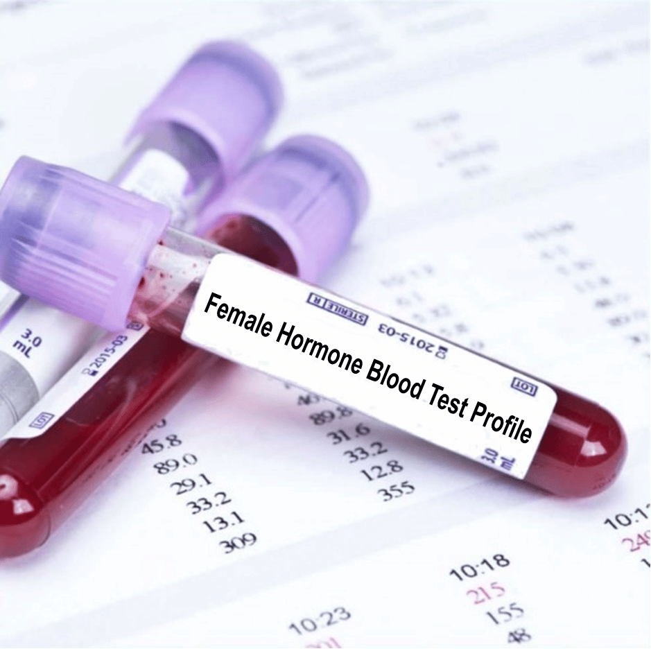Female Hormone Blood Test Profile