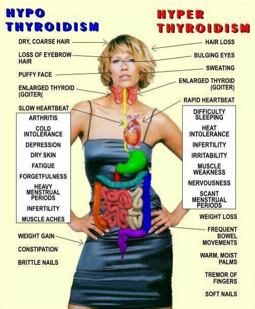 For those who have doubts about thyroid!!