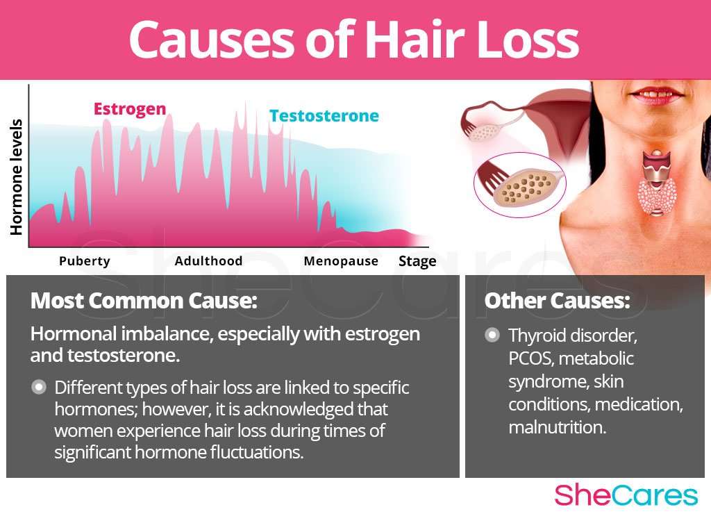 Hair Loss Hormones Female