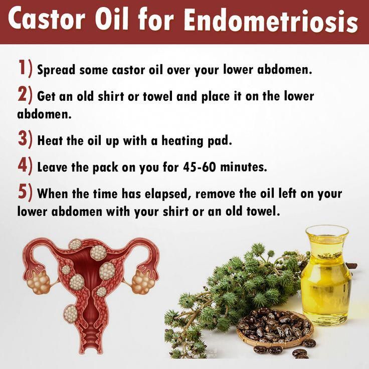 Herbal Remedies For Endometriosis Symptoms