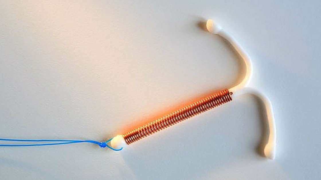 Hereâs Everything You Need To Know Before Getting An IUD ...