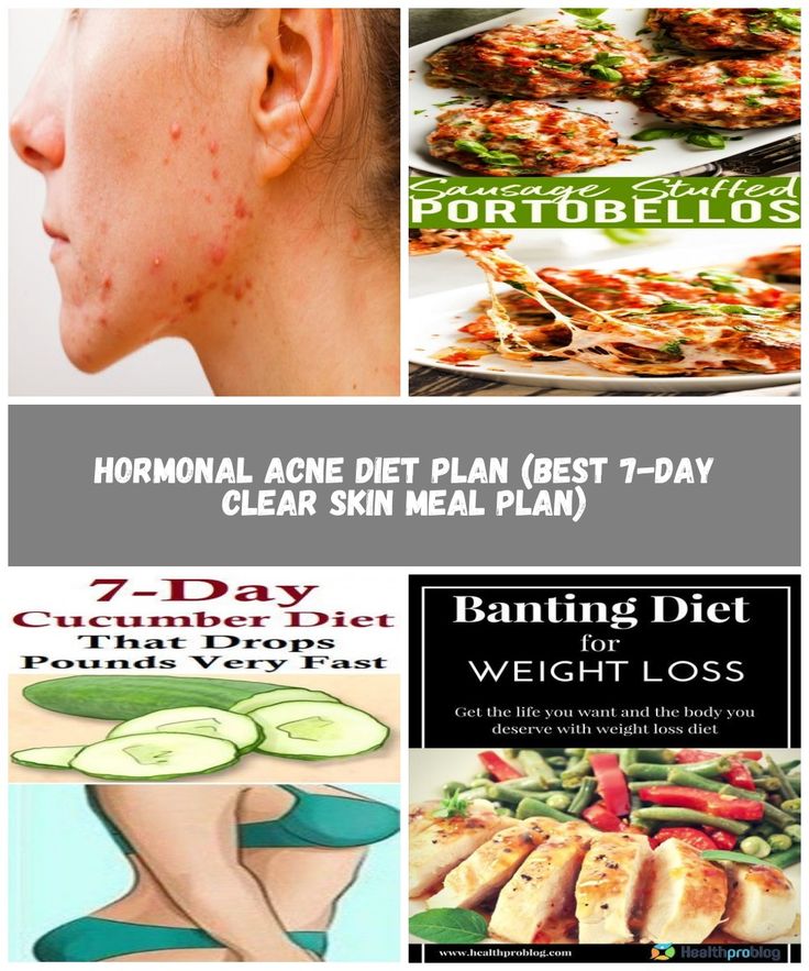 Hormonal Acne Diet Plan (best 7