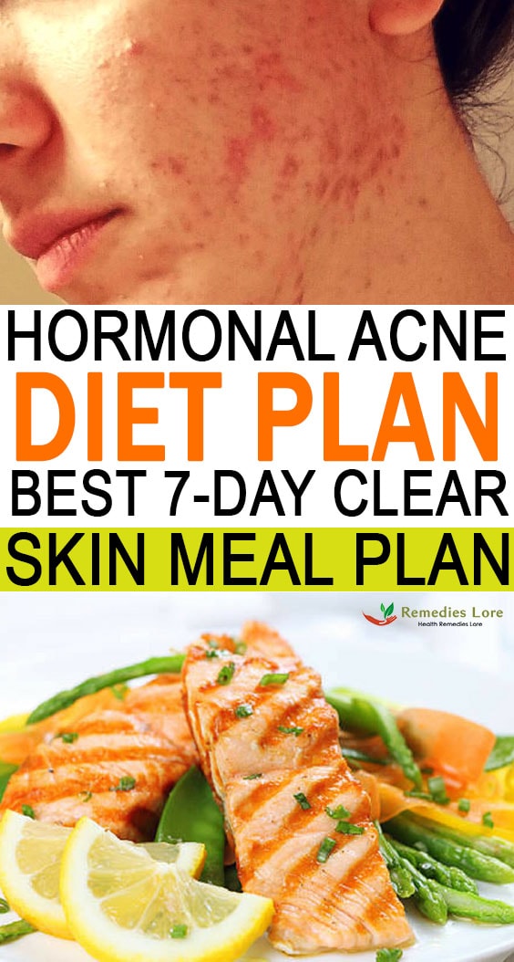 Hormonal Acne Diet Plan (Best 7