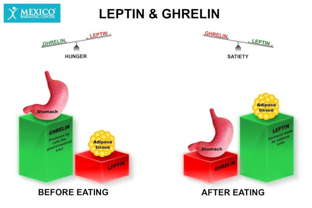 How Bariatric Surgery Reduces Hunger Hormones (Ghrelin)?