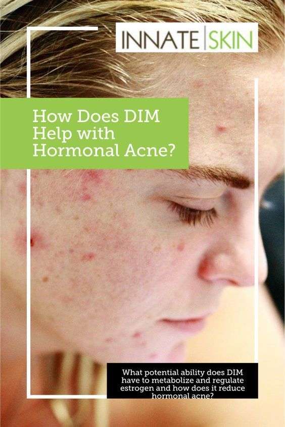 How Long Does It Take To Get Rid Of Hormonal Acne  ho ...