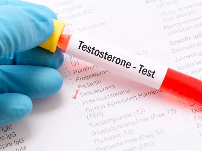 How much do testosterone levels really matter?