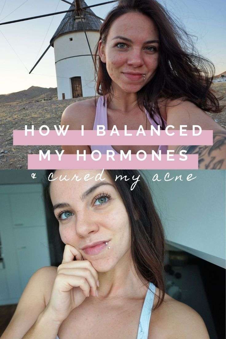 How To Balance Hormones Naturally (And Clear Hormonal Acne ...