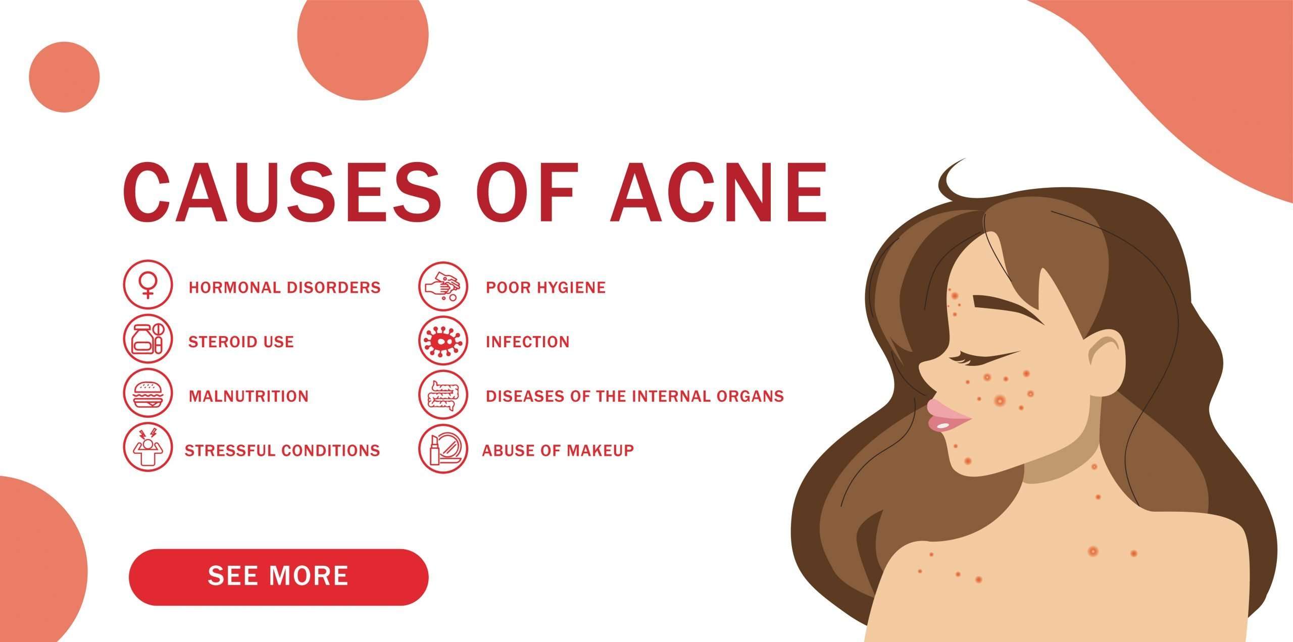 How to Balance Hormones to Reduce Hormonal Acne