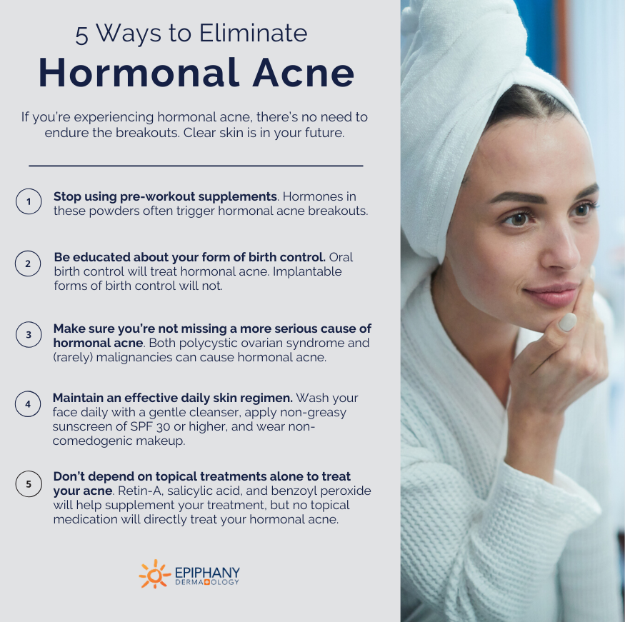 How to Get Rid of Hormonal Acne: Diagnosis &  Treatment Options