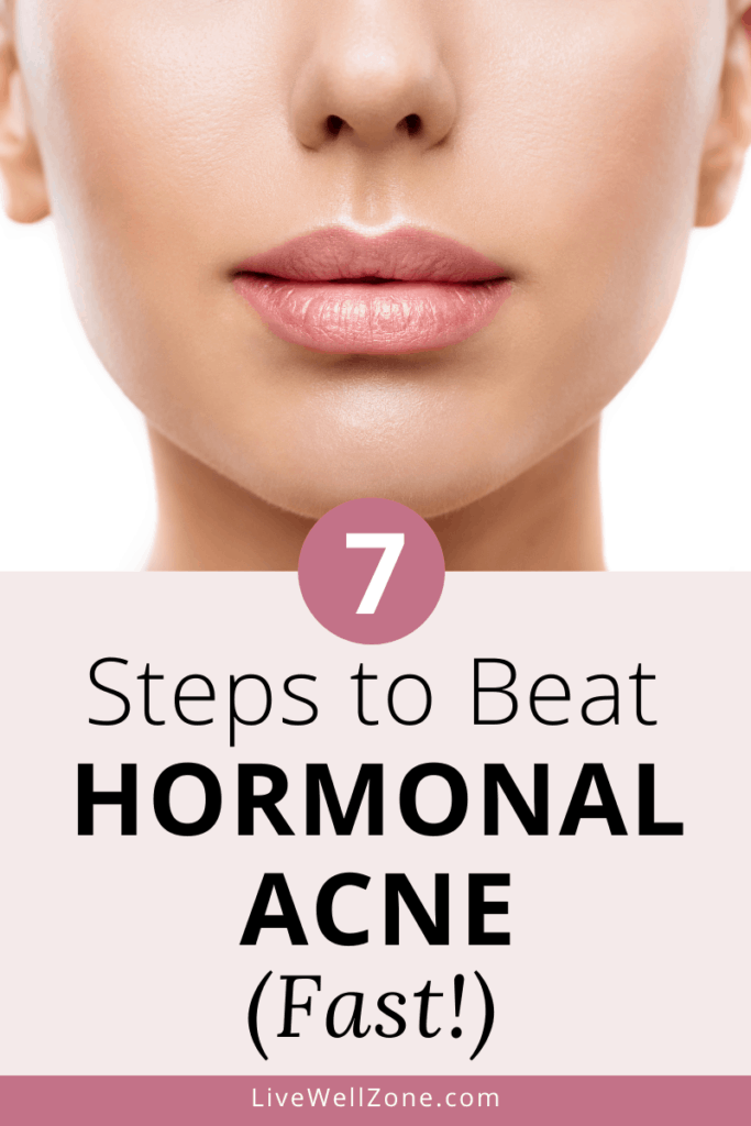 How To Get Rid of Hormonal Acne Naturally &  Fast: A 7