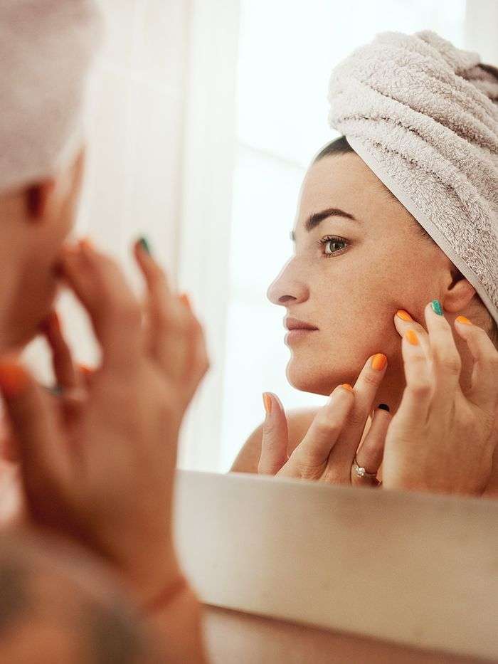 How to Prevent Hormonal Acne, According to Experts