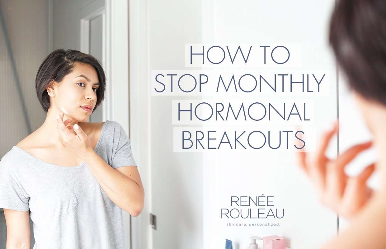 How to Stop Monthly Hormonal Acne