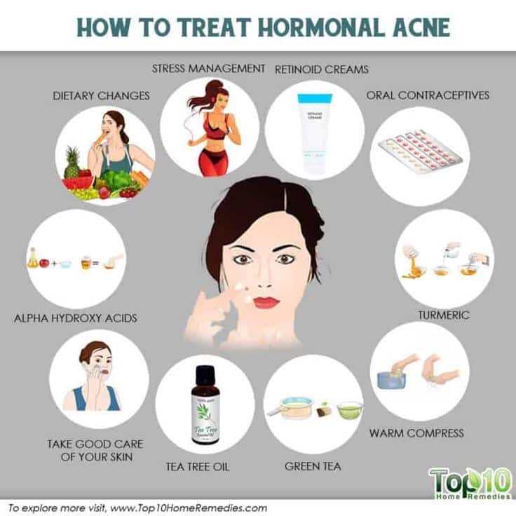 How to Treat Hormonal Acne