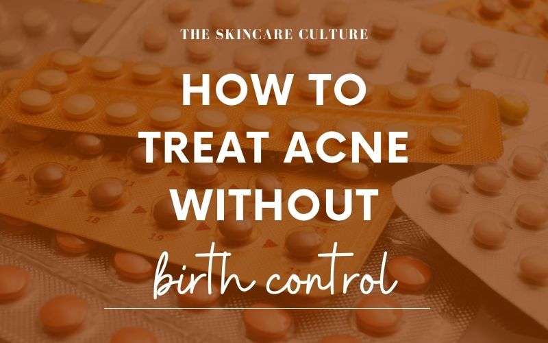 How To Treat Hormonal Acne Without Birth Control (10 Tips)