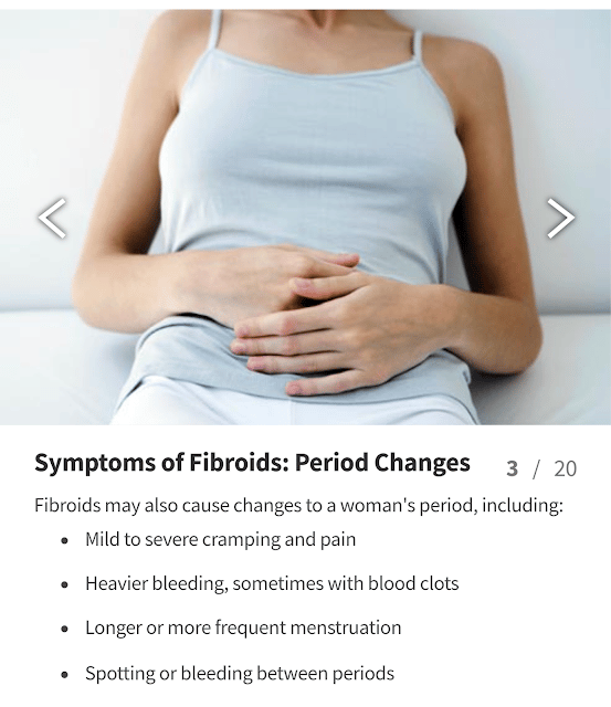 In Case You Missed: Uterine Fibroids