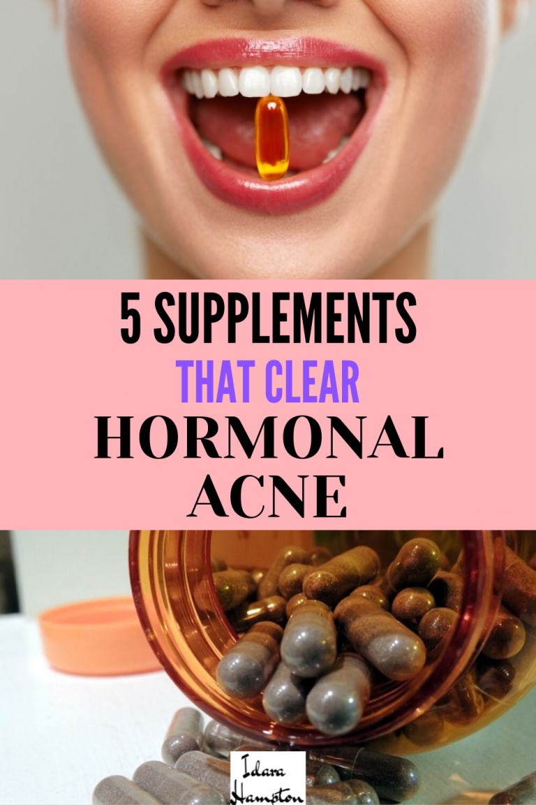 Is hormonal acne driving you crazy? I
