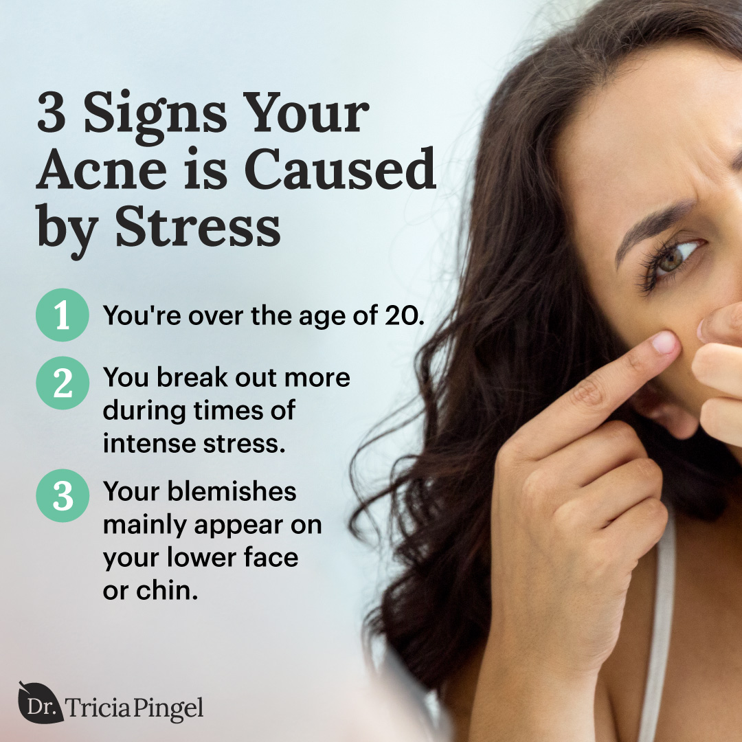 Is Your Acne Caused by Stress?