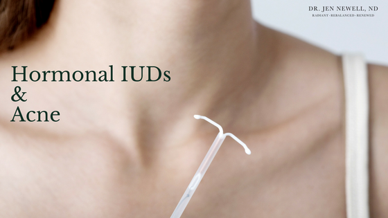 Is your hormonal IUD the cause of your acne?