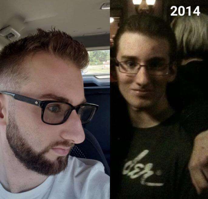 Just found this community! Me (FTM) in 2014 (right) before ...