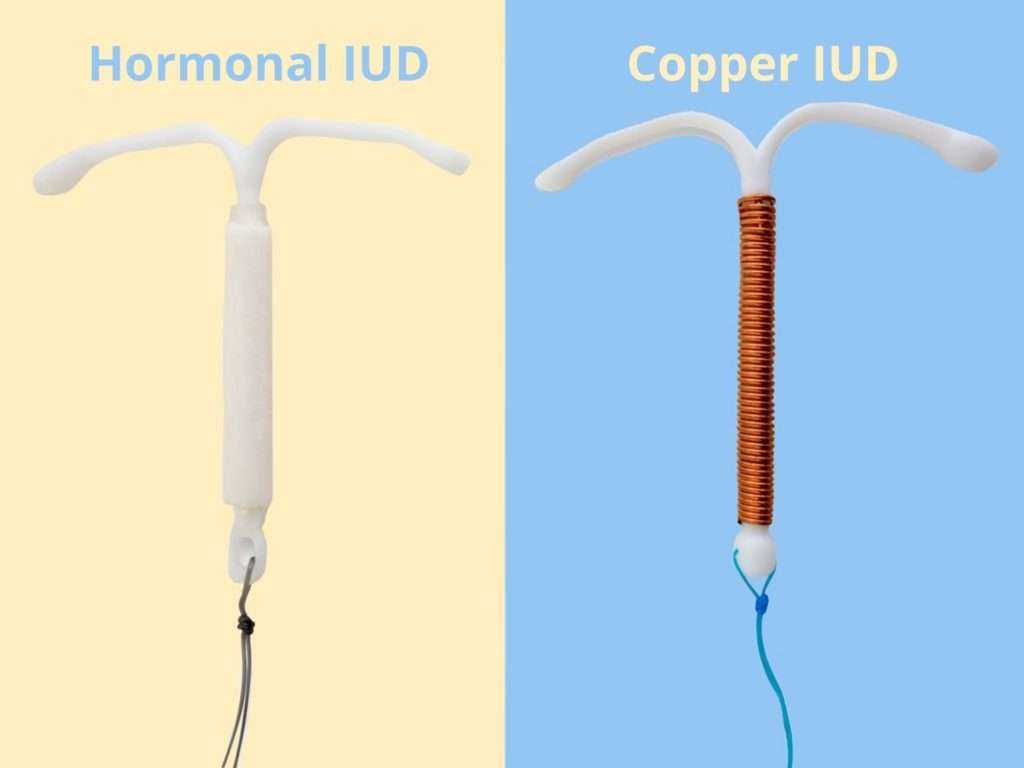 Meet the IUD: Introduction into IntraUterine Device