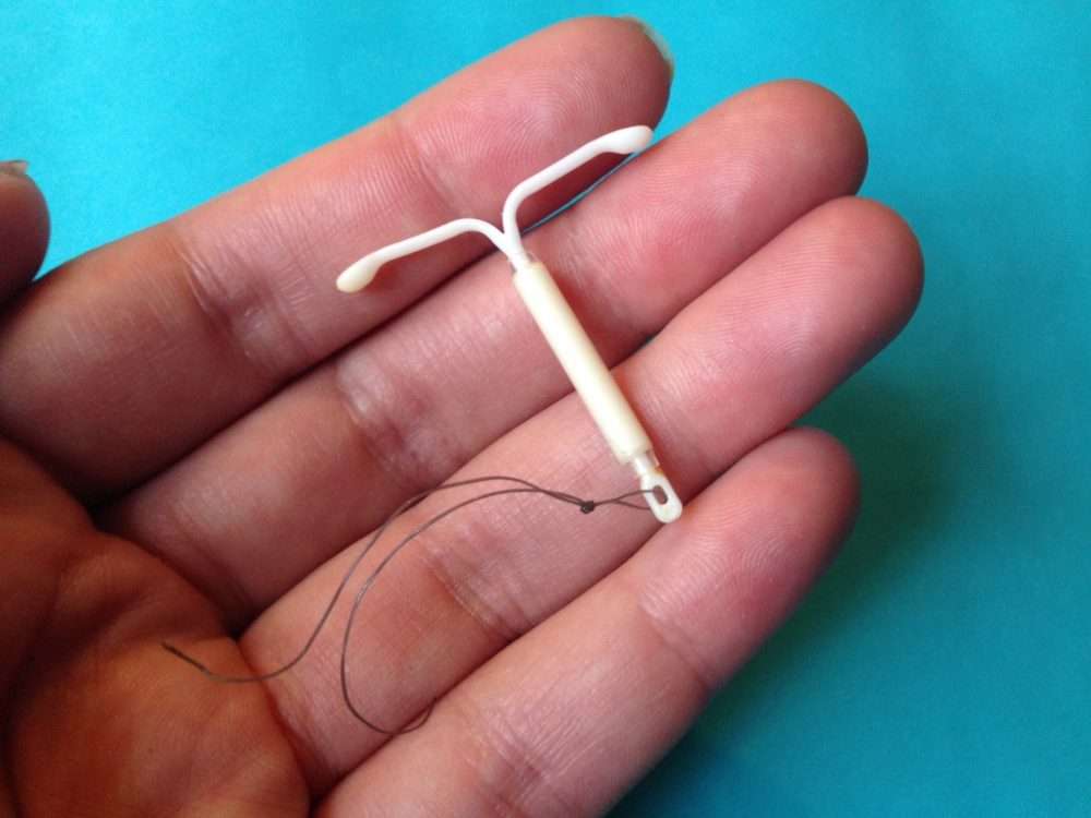 More Than 20,000 Women Rushed To Get IUDs Right After Trump Elected ...