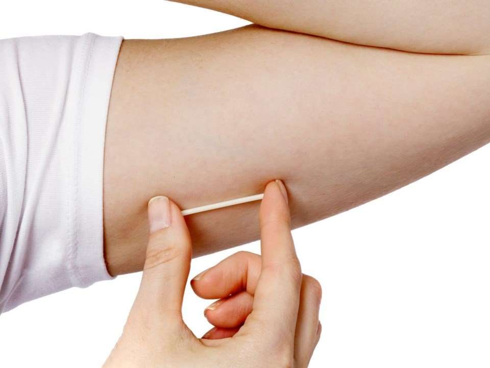 New implant device provides continuous birth control for ...