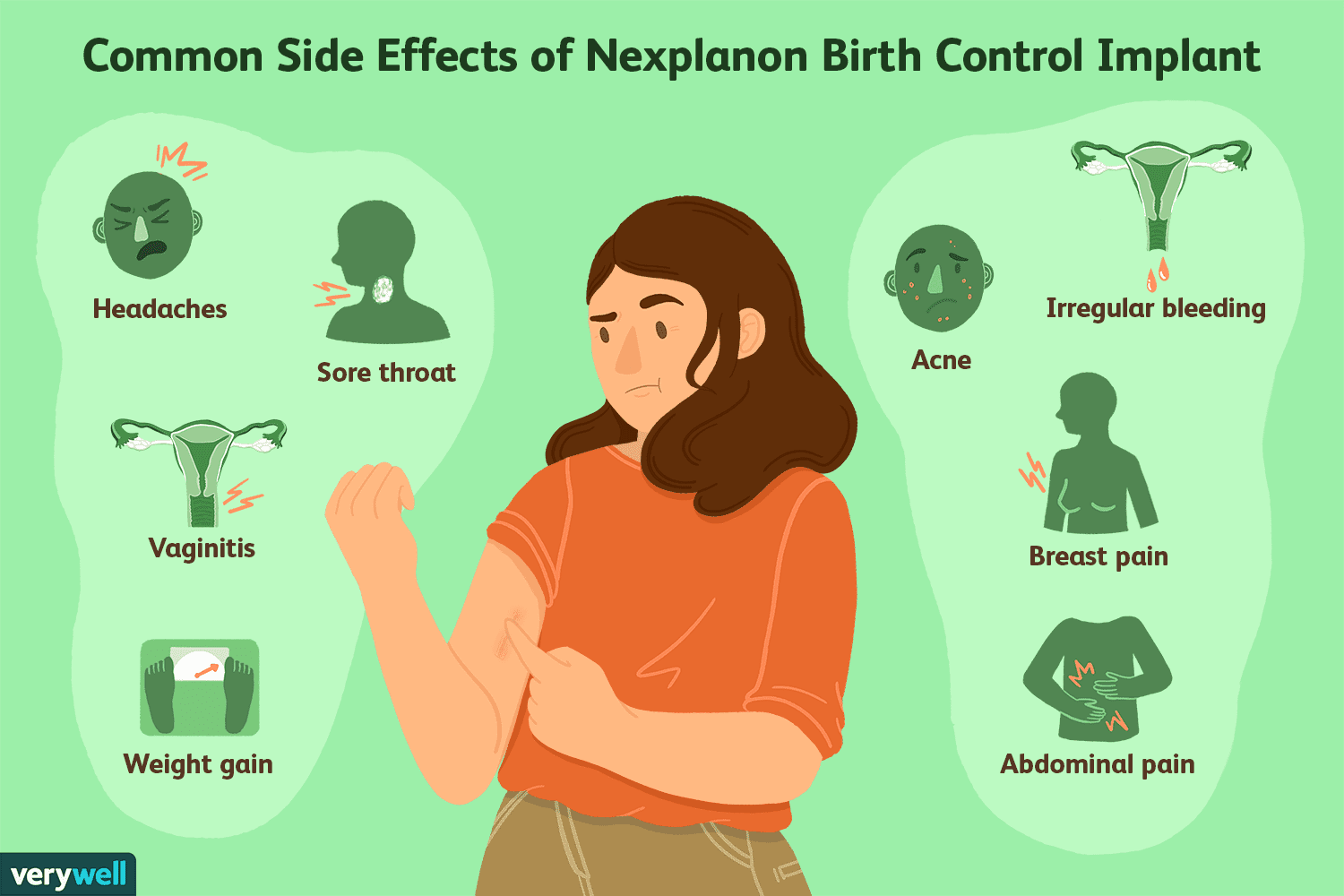 Nexplanon: What You Should Know About the Birth Control ...