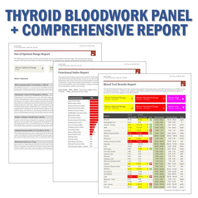 NwJ Thyroid Bloodwork Panel + Comprehensive Report