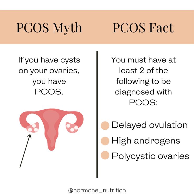 PCOS Myth vs Fact
