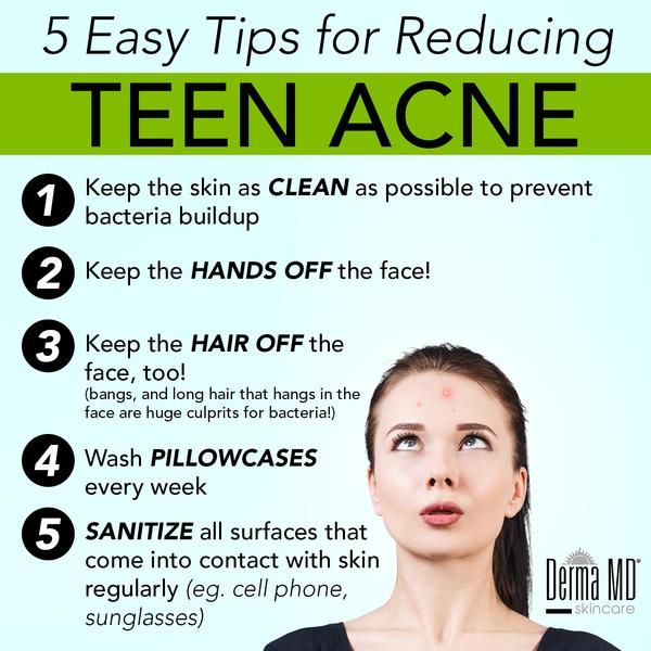 Pin on Acne Care