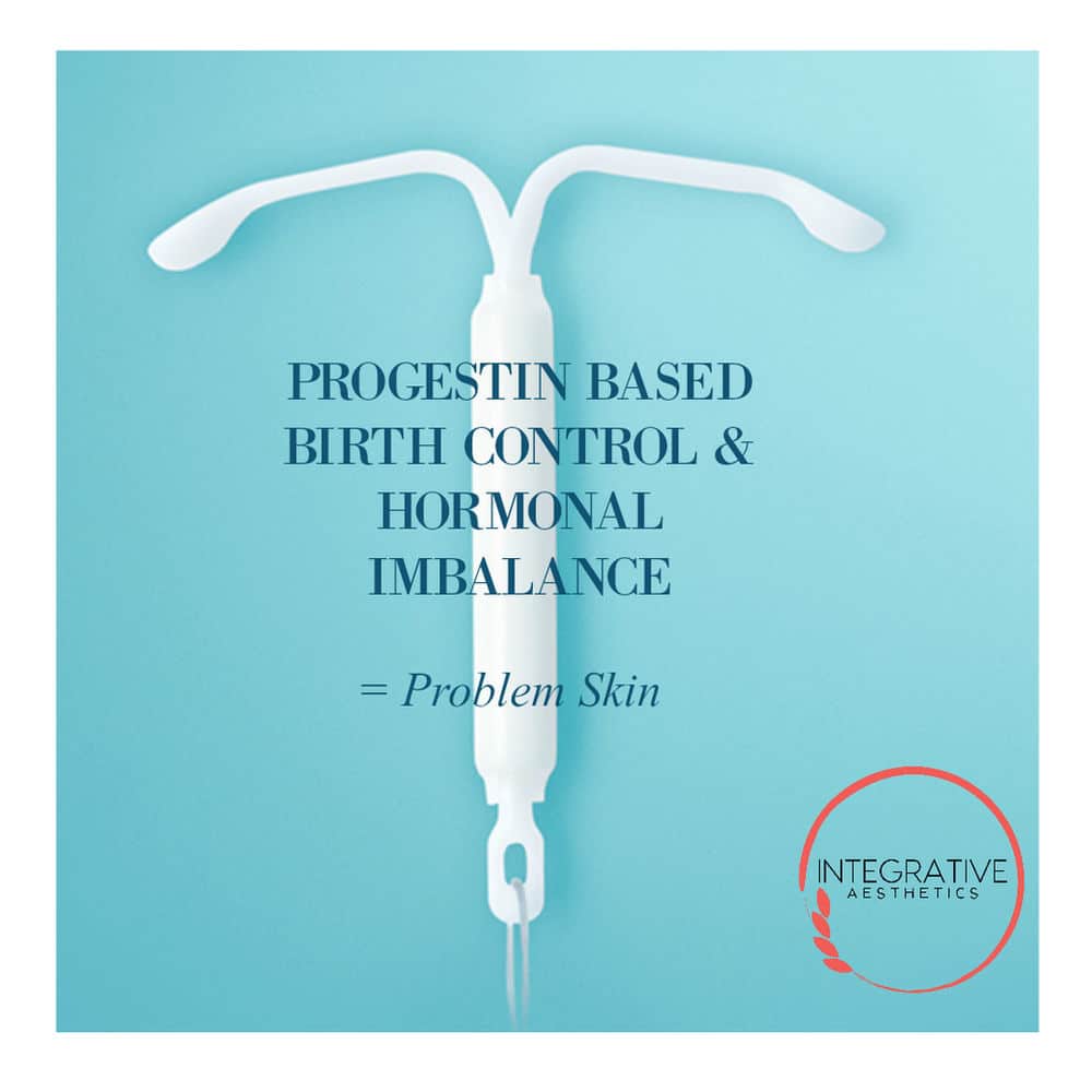 Progestin Based IUD and Hormonal Imbalance