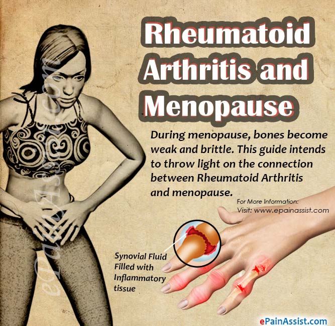 Rheumatoid Arthritis and Menopause: What You Need to Know