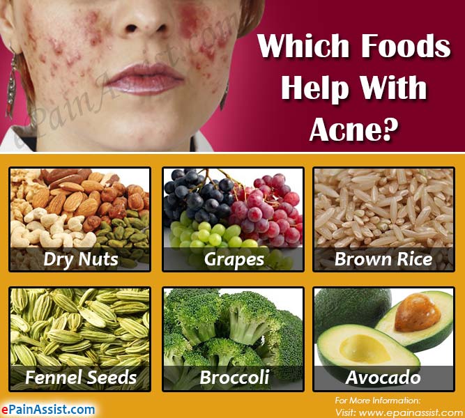 Sell Foods That Cause Acne Pimples Background