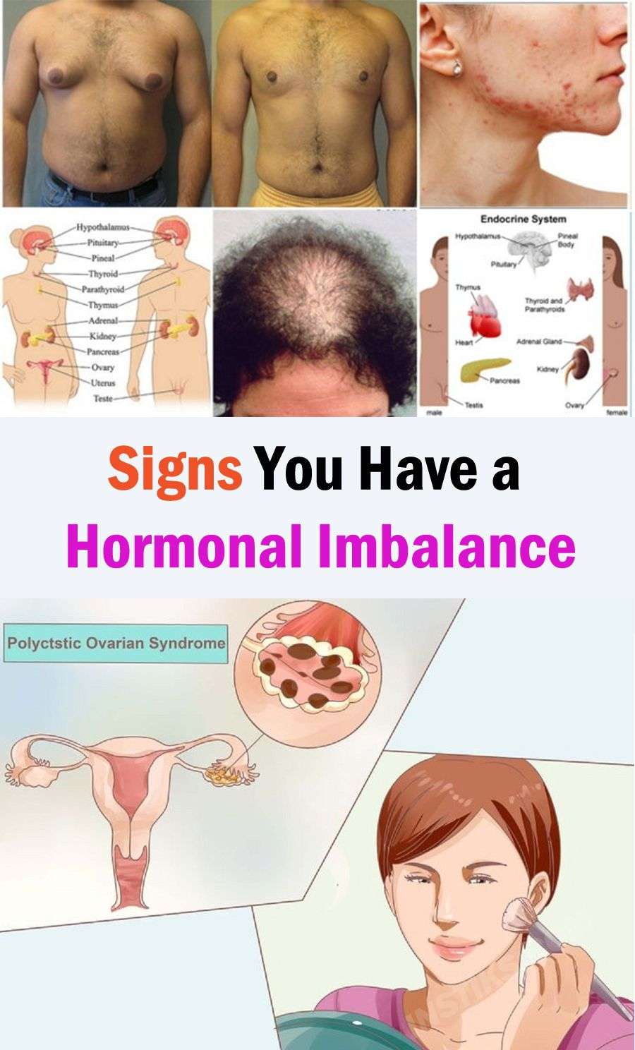 Signs You Have a Hormonal Imbalance &  How to Correct It